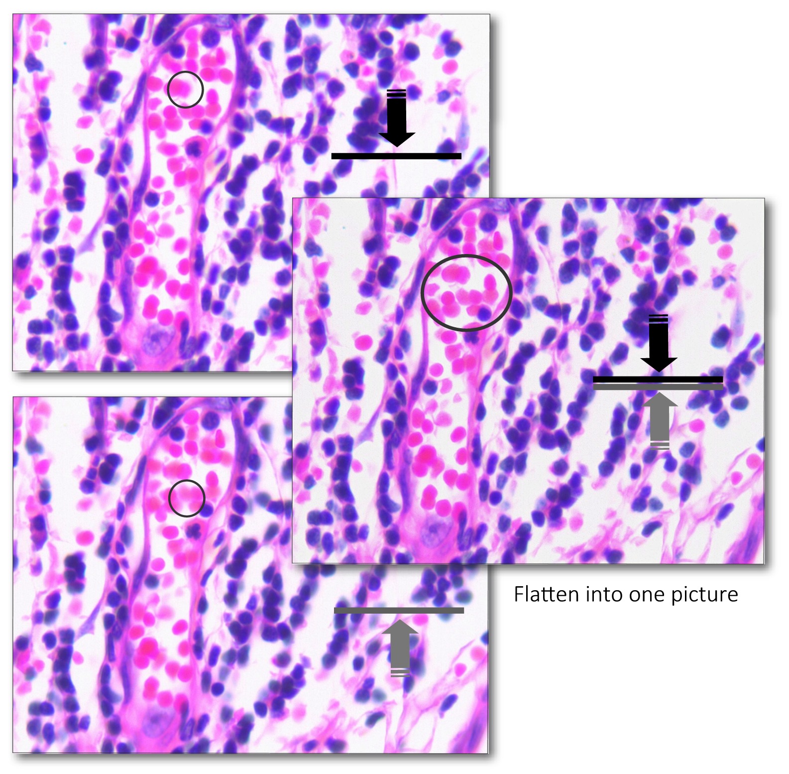 Multifocal Fusion